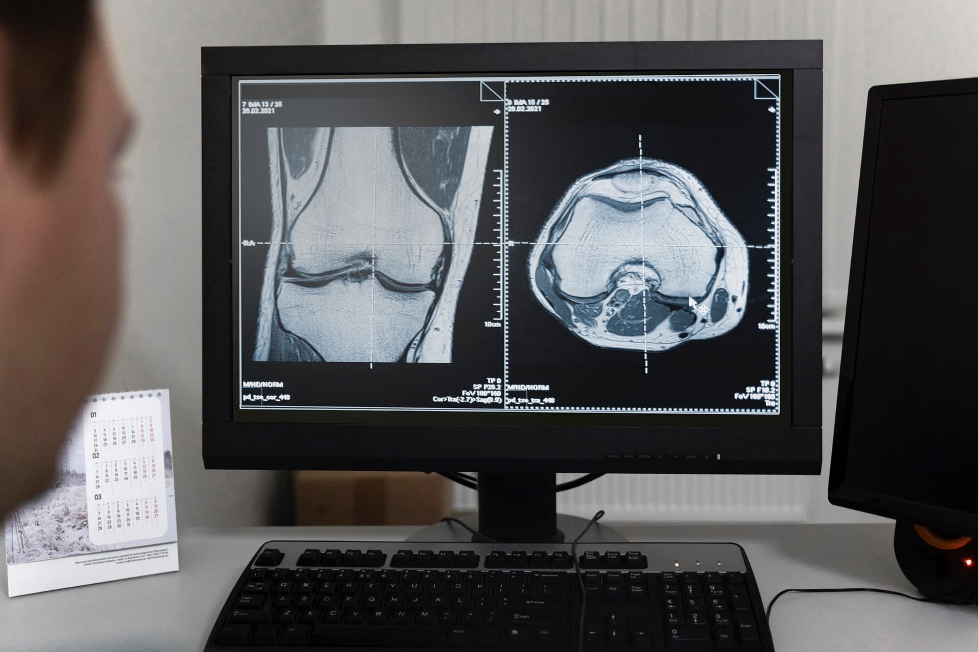 Motion-Based Biomarkers in Knee Disorders completed study